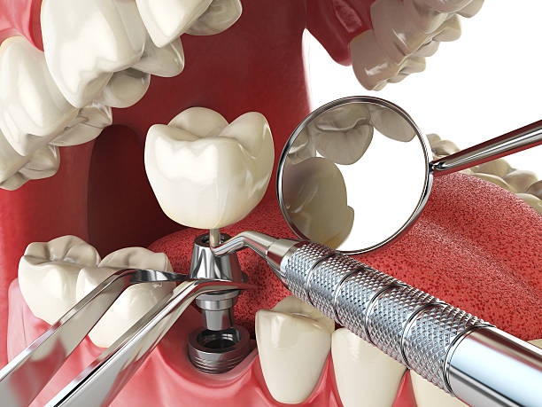 Best Emergency Cosmetic Dentistry (e.g., broken veneers) in Mallory, WV